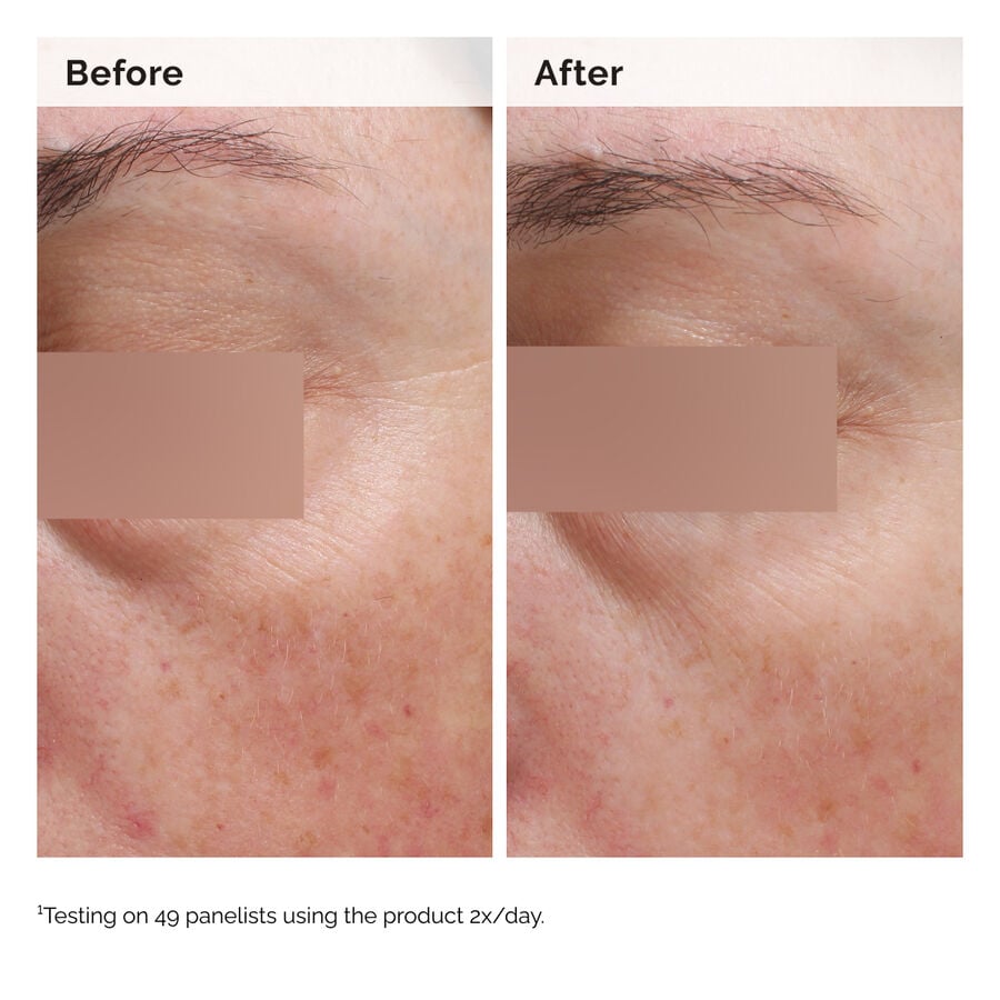 niacinamide-5-face-and-body-emulsion-c3 2024-08-23-ORD-Nia-5pct-Face-Body-B-A-Elasticity-Global-02-1x1.jpg