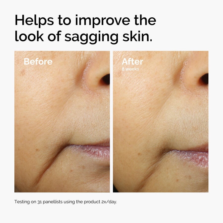 caffeine-3-escin-1-face-serum-y4 ord-caffeine-3pct-escin-1pct-face-serum-before-after-sagging.jpg