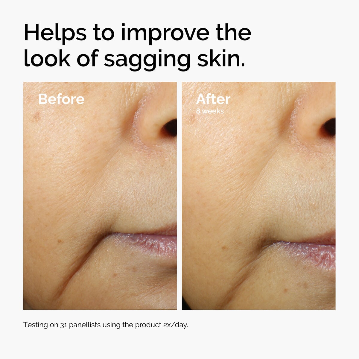caffeine-3-escin-1-face-serum-y4 ord-caffeine-3pct-escin-1pct-face-serum-before-after-sagging.jpg