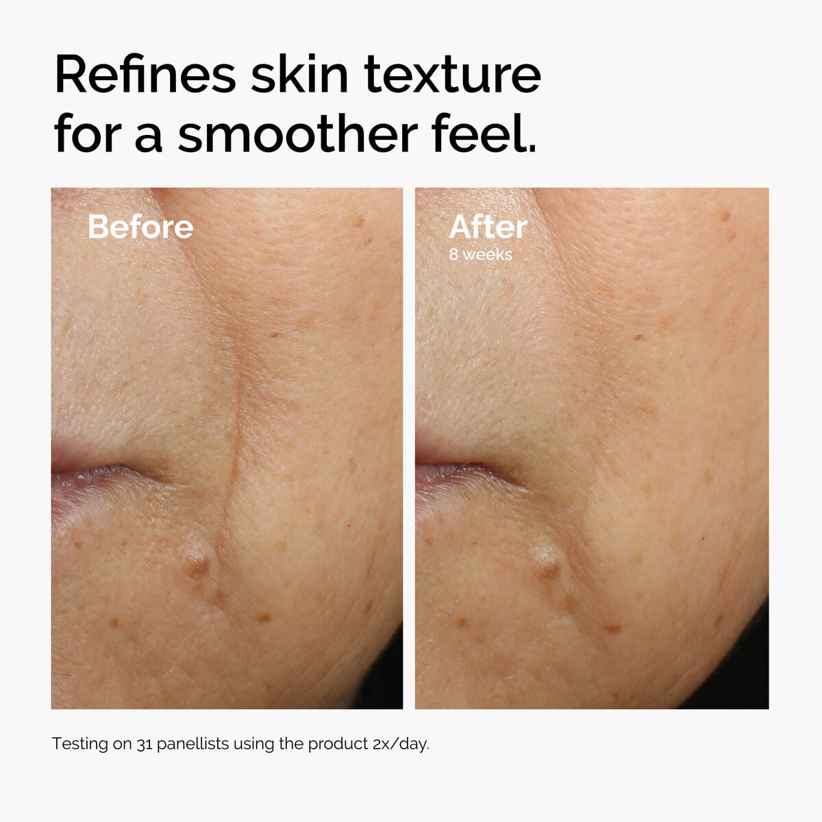 caffeine-3-escin-1-face-serum-y4 ord-caffeine-3pct-escin-1pct-face-serum-before-after-texture.jpg