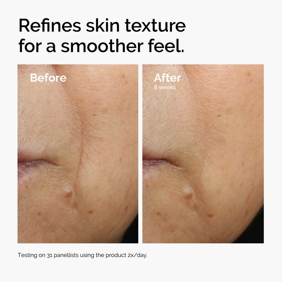 caffeine-3-escin-1-face-serum-y4 ord-caffeine-3pct-escin-1pct-face-serum-before-after-texture.jpg