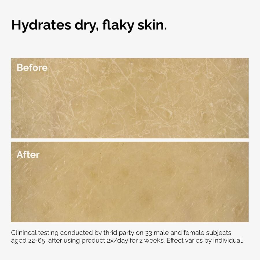 the-body-care-collection-o5 ord-natural-moisturizing-factors-inulin-body-before-after-graphic-02.jpg