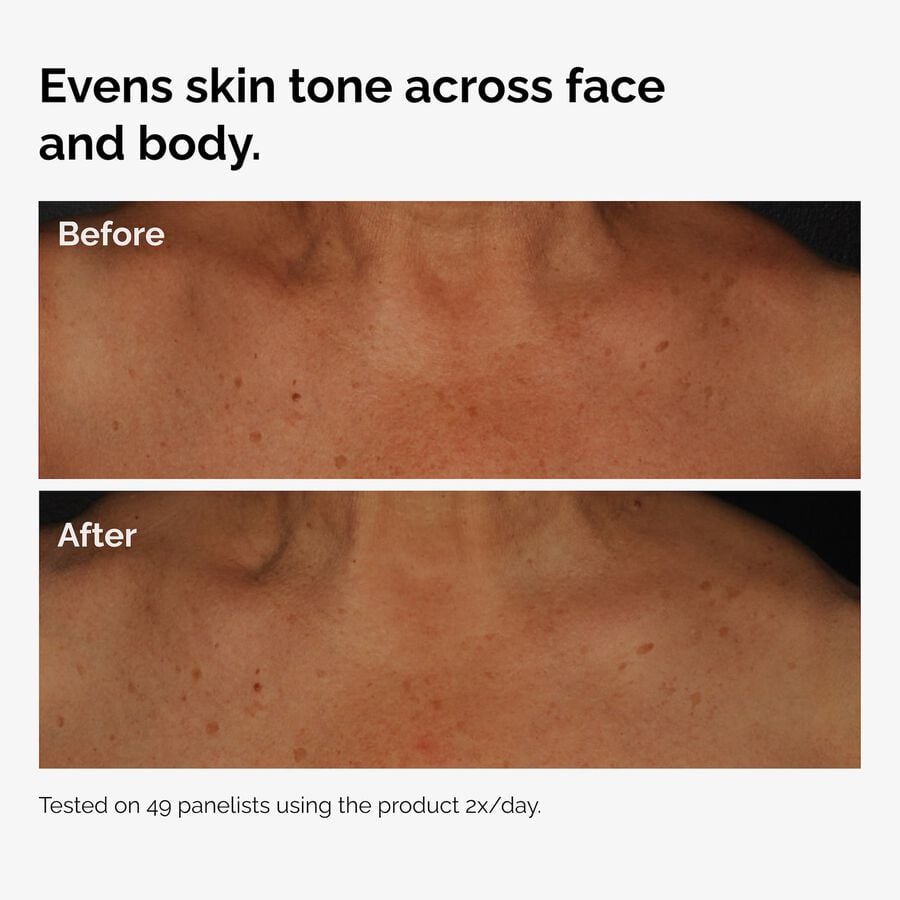 the-body-care-collection-o5 ord-niacinamide-face-body-serum-before-after-even-tone-graphic.jpg
