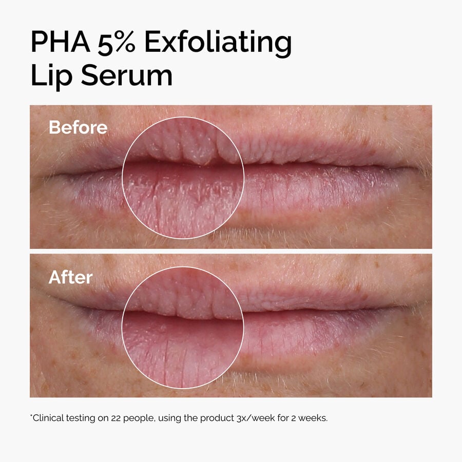 pha-5-exfoliating-lip-serum-l0 ord-pha-5pct-lip-exfoliating-serum-before-after.jpg