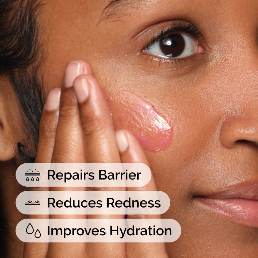 soothing-and-barrier-support-serum-set-f1 ord-soothing-barrier-support-serum-model-application-with-benefits.jpg