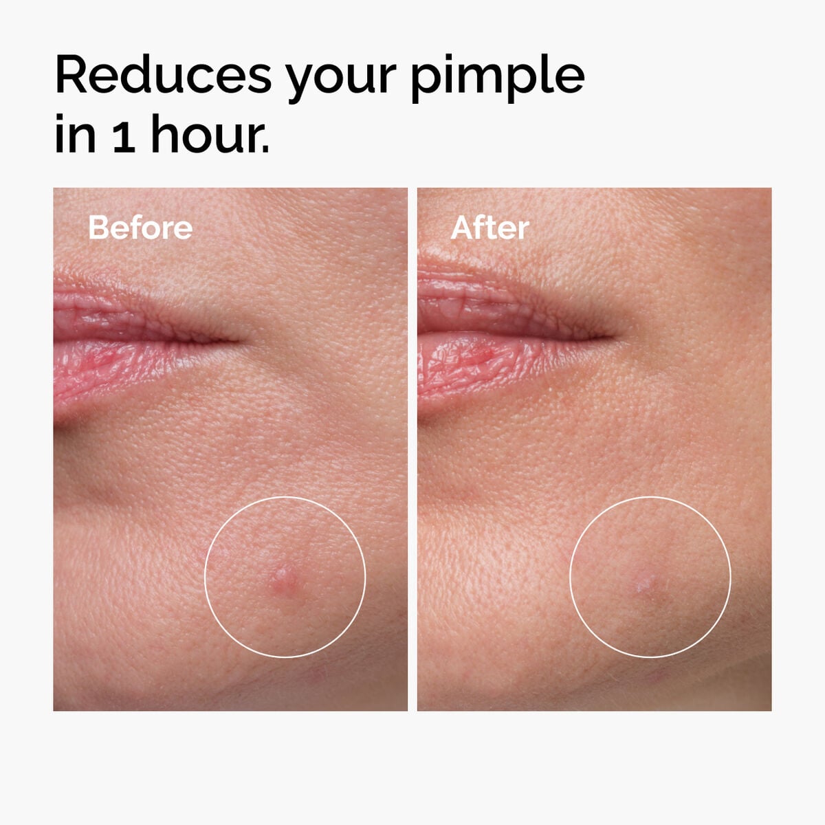 sulfur-10-powder-to-cream-concentrate-l4 ord-sulfur-10pct-powder-to-cream-concentrate-before-after-NA.jpg