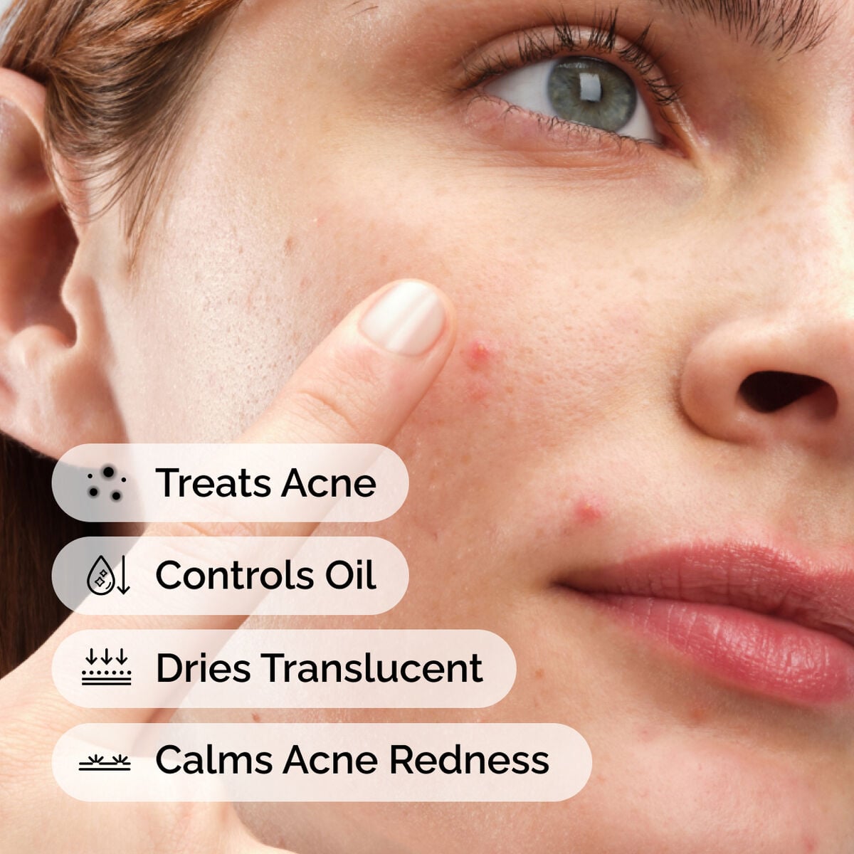 sulfur-10-powder-to-cream-concentrate-l4 ord-sulfur-10pct-powder-to-cream-concentrate-model-application-with-benefits-acne.jpg